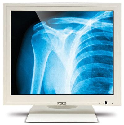 GVision Touchscreen